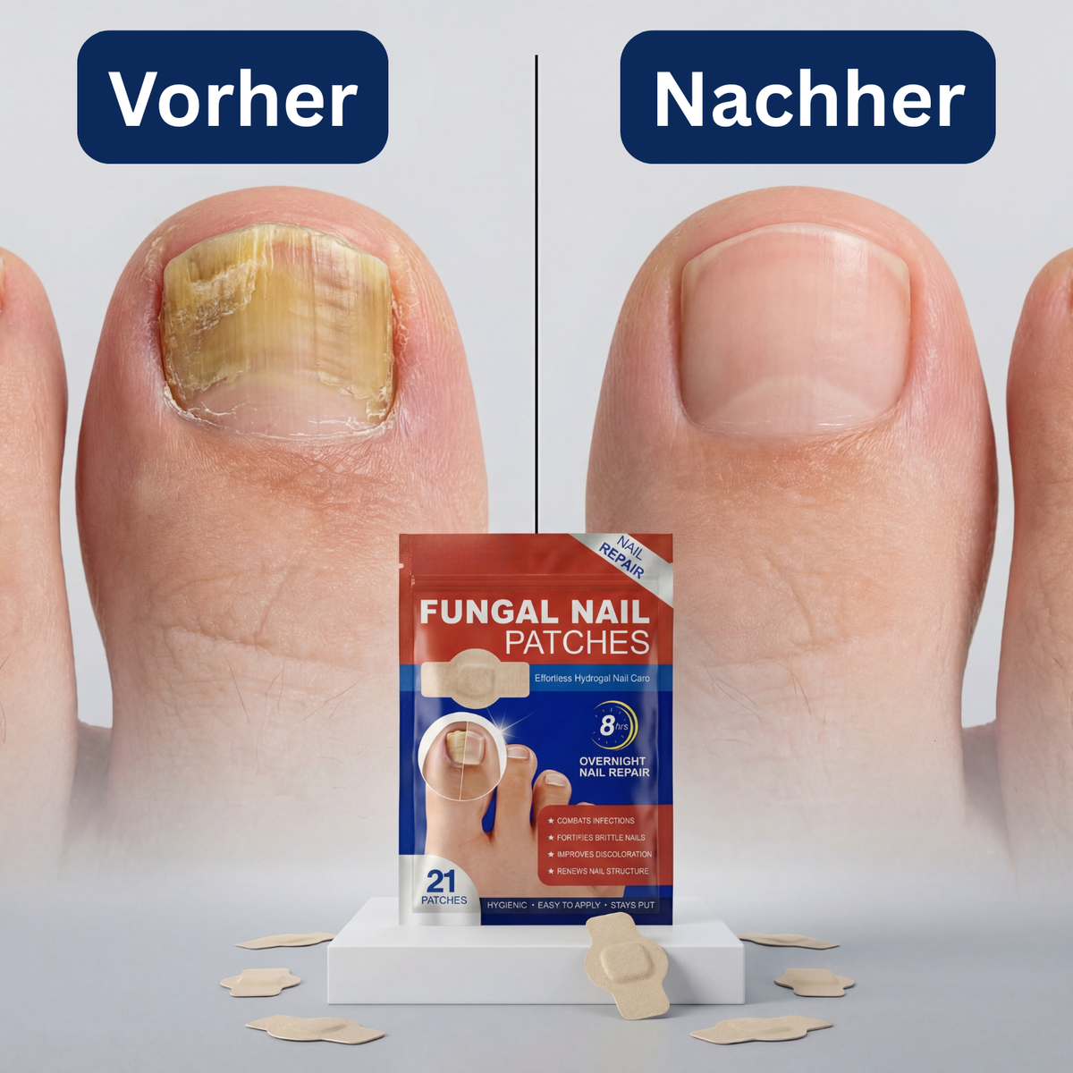 Elevara Patches - die Patches für schönere Fussnägel
