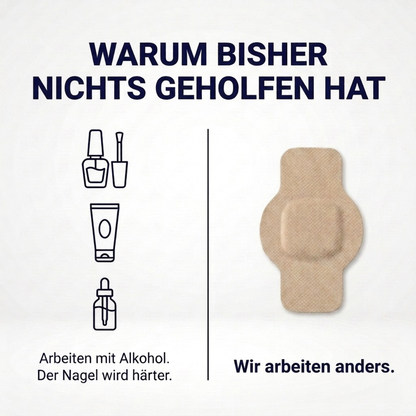 Elevara Patches - die Patches für schönere Fussnägel
